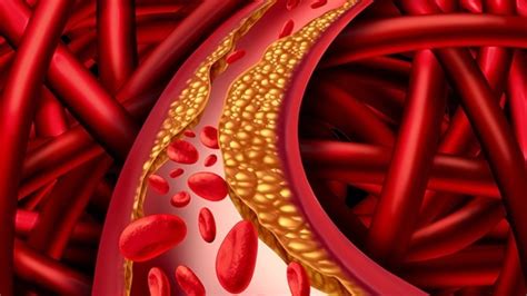 血管炎的好发人群有哪些，如何鉴别诊断血管炎？-血管炎概况-复禾健康