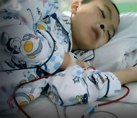 黑龙江出生87天的男婴被父亲烫伤，腿骨折、血肿……87天后，他怎么样了？