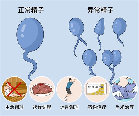 准备要做人工授精了精子活力不好怎么办-深圳中山妇产医院