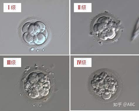 胚胎等级的区分 - 知乎