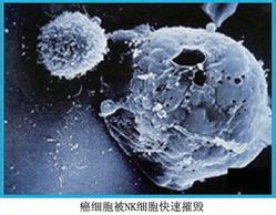 NK细胞免疫治疗及CAR-NK技术-免疫-转化医学网-转化医学核心门户
