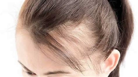 女人掉头发很厉害是什么原因 六个点看透掉发-孕前保健-妈妈宝宝网
