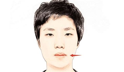 轻微嘴歪图片