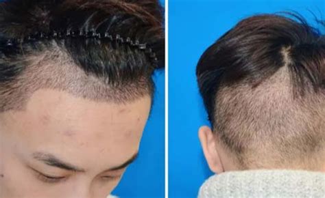 发际线高的男士头发应该怎么剪？_发型