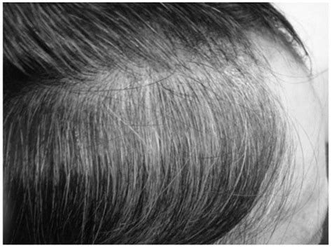 【图】治疗白发变黑发有效的方法 有什么需要注意的(2)_伊秀美容网|yxlady.com