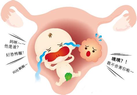 宫外孕和黄体破裂的症状解析：大出血只是相似症状之一_家庭医生在线