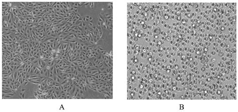 胶质瘤U87细胞--纳米医学网-生物纳米技术服务平台