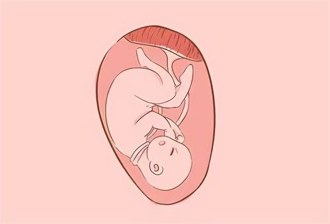 胎儿绕颈一圈怎样改善，脐带绕颈一圈怎么办