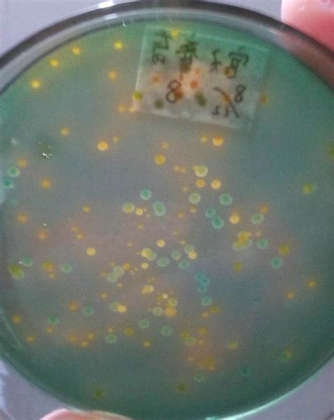 水中常见的细菌在显微镜下会是什么样子？_净水器资讯