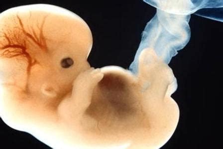 阴道超声引导下胚胎移植对反复种植失败患者妊娠结局的影响