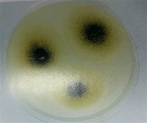 常见细菌可以用普通光学显微镜看到吗？ - 知乎