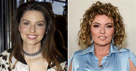 Shania Twain Plastic Surgery: Did the Country Star Go Under the Knife?