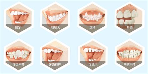 12道题检测你的牙齿健康+护牙小知识|牙齿|牙齿健康|牙龈_新浪新闻