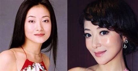 熊黛林眼睛整容了嘛图片