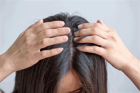 脱发的原因有哪些呢？什么原因会导致脱发？ – 生发垂直网