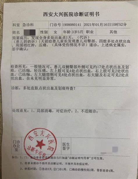陕西西安一幼儿园身现29处针眼3岁女童 家长：已报警处理_杭州网