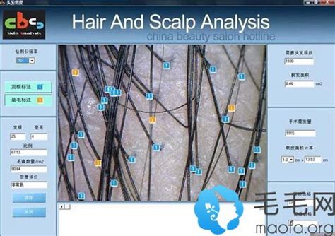 劈尖干涉测量头发丝直径 - 豆丁网
