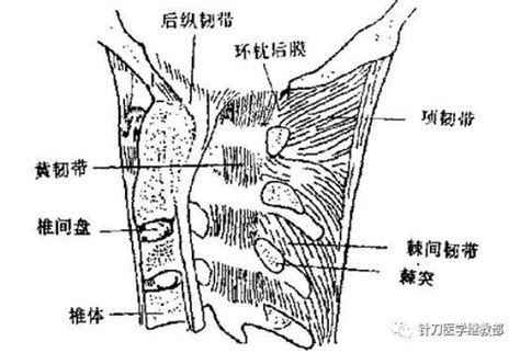 棘上韧带位置图图片
