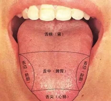 舌象分析图片