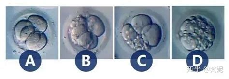 什么是优质胚胎？哪些胚胎更容易养囊胚？ - 好孕无忧
