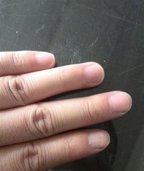 手指甲上的月牙什么意思，代表什么-参考经验网