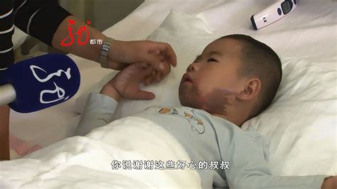 热油淋了一身 四岁男孩被烫伤 众人接力救援_腾讯视频