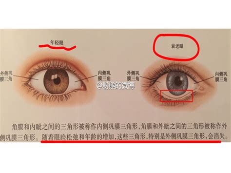 下三白眼图片