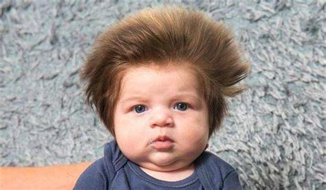 刚出生的宝宝，为什么有的头发浓密，有的稀疏不妨提前了解下！