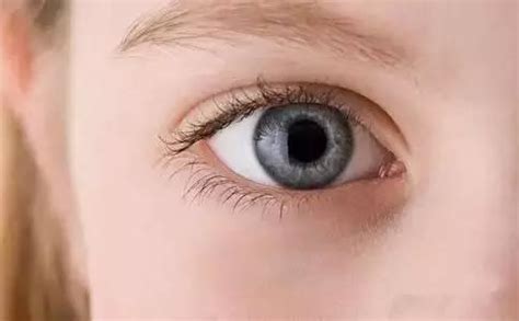 眼睛出现这5种症状, 可能你的肝脏已经受损严重, 这样调理可恢复!