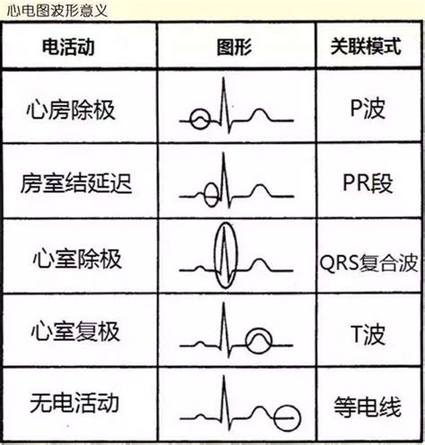 心电图入门图片