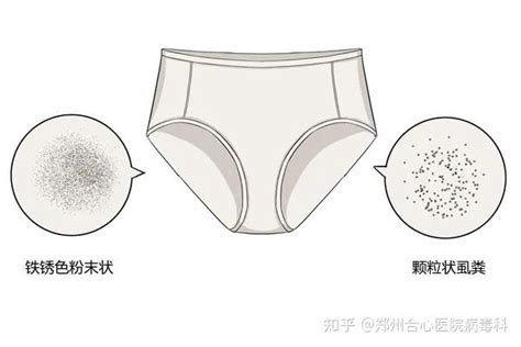 【图】珍珠内裤可以经常穿吗 一起来了解它的特殊的功效_内裤_伊秀服饰网|yxlady.com