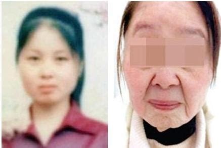 河南28岁女变80老太图,少妇得怪病原因及图片曝光(2)_免费QQ乐园