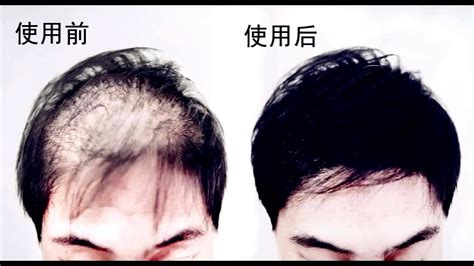 头发的生长周期 | 染发基础讲座 | 朋友(上海)化妆品销售有限公司
