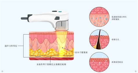 网红抗衰神器——半岛超声炮凭什么这么火？-健康160