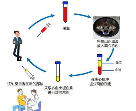 富血小板血浆（PRP）—再生修复新篇章_组织