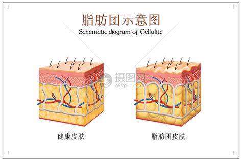 脂肪图片