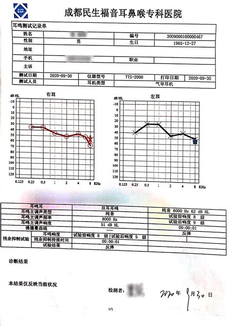一文看懂超声换能器电参数测试要点-广州致远电子股份有限公司