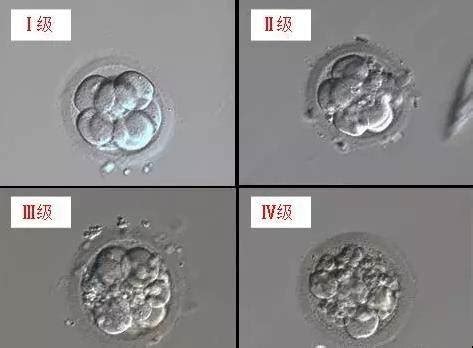 胚胎移植第13天hcg正常值