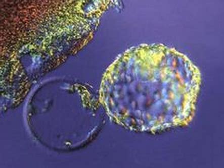 囊胚培养的流程和养囊成功率
