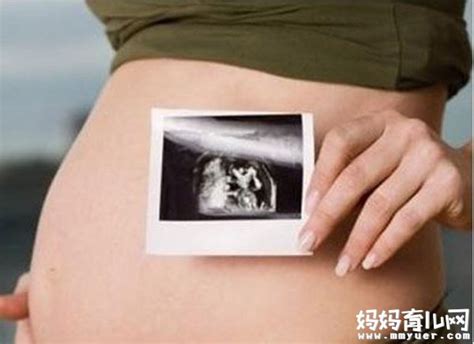六个月的胎儿查出兔唇，原因让妈妈无法原谅自己