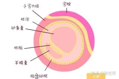 孕囊6毫米未见卵黄囊及胎心