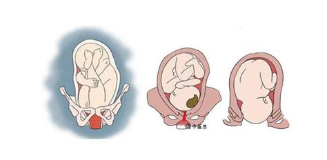 分娩时宫口张开是咋回事