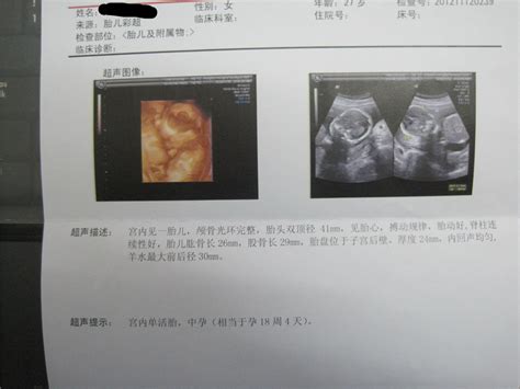 怀孕男孩女孩医生暗语