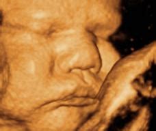 怀孕8-10个月胎教音乐