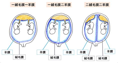 胎动像被蹬了一下是异常吗