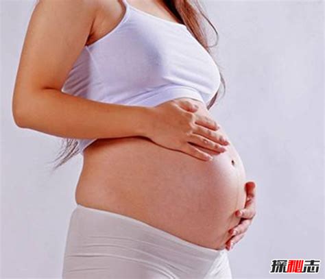 什么因素会导致假性怀孕