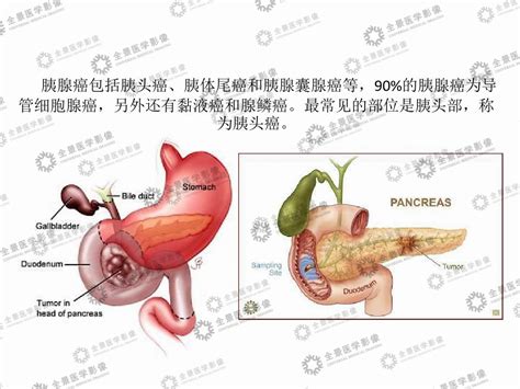 胰和脾图片