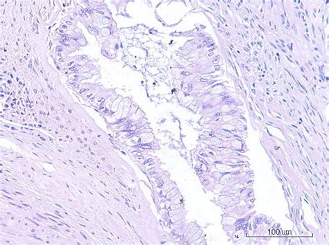 清宫手术会影响子宫内膜吗