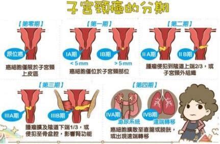 宫颈分泌物阳性是什么意思