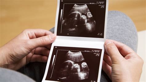 胎儿生长受限跟孕妇睡姿有关系吗